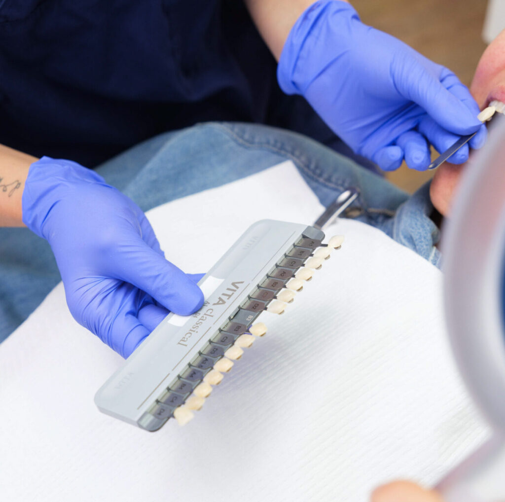 Zahnbleaching – strahlend weiße Zähne fürs neue Jahr