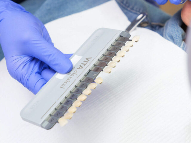 Zahnbleaching – strahlend weiße Zähne fürs neue Jahr